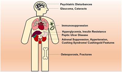 Corticosteroids in COVID-19: pros and cons